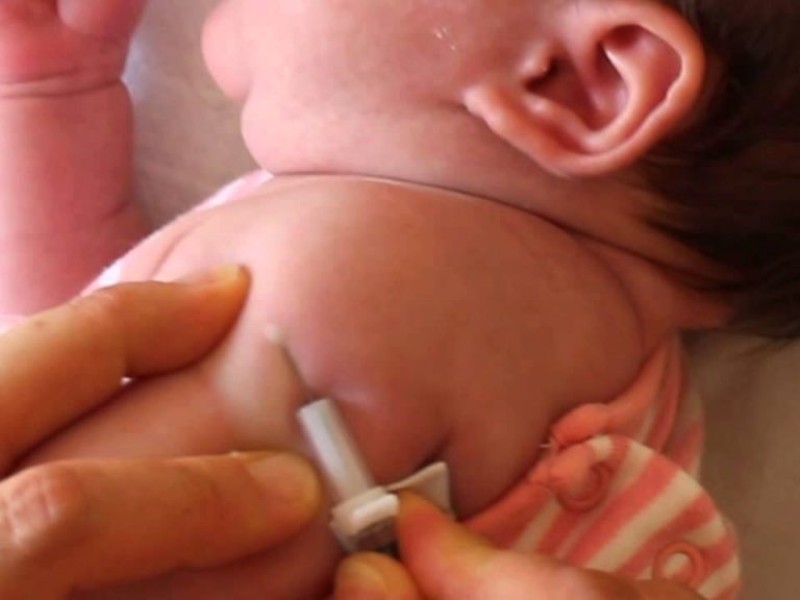 La ciudad fortalece la cobertura de vacunación neonatal con la incorporación de la BCG en clínicas privadas